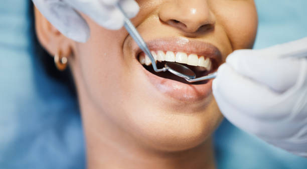 Best Emergency Dentist for Lost Fillings or Crowns in Hokendauqua, PA