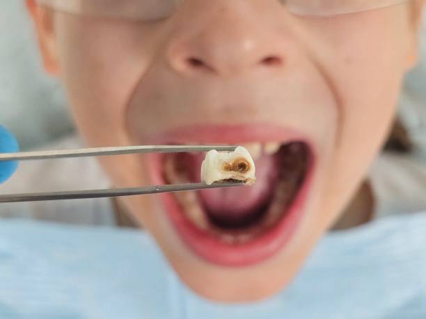 Best Pediatric Emergency Dentist in Hokendauqua, PA